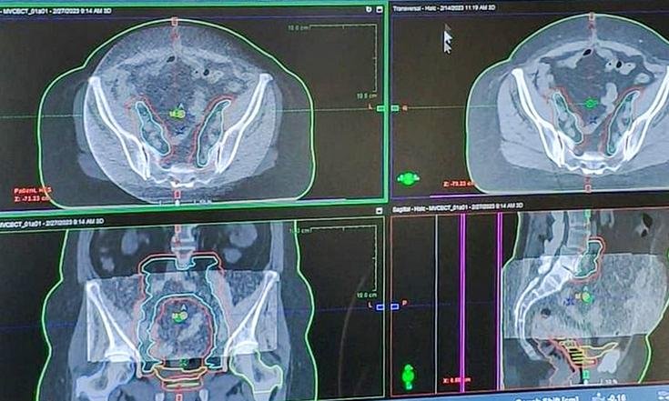 Тверская область, Тверь, улица 15 лет Октября, 57/37. Новый линейный ускоритель. Фото: официальный сайт правительства Тверской области тверскаяобласть.рф